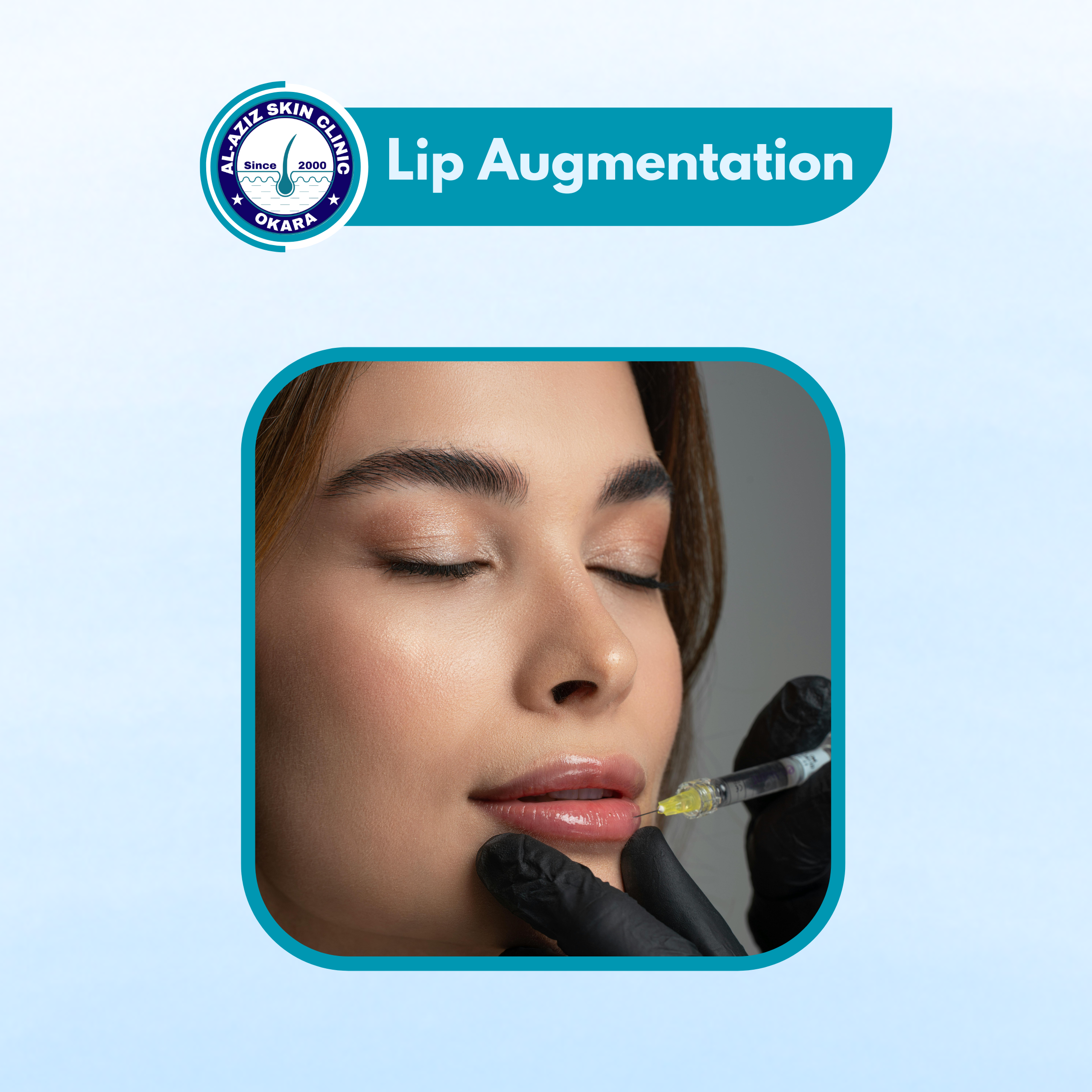 Lip Augmentation