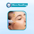 Micro Needling