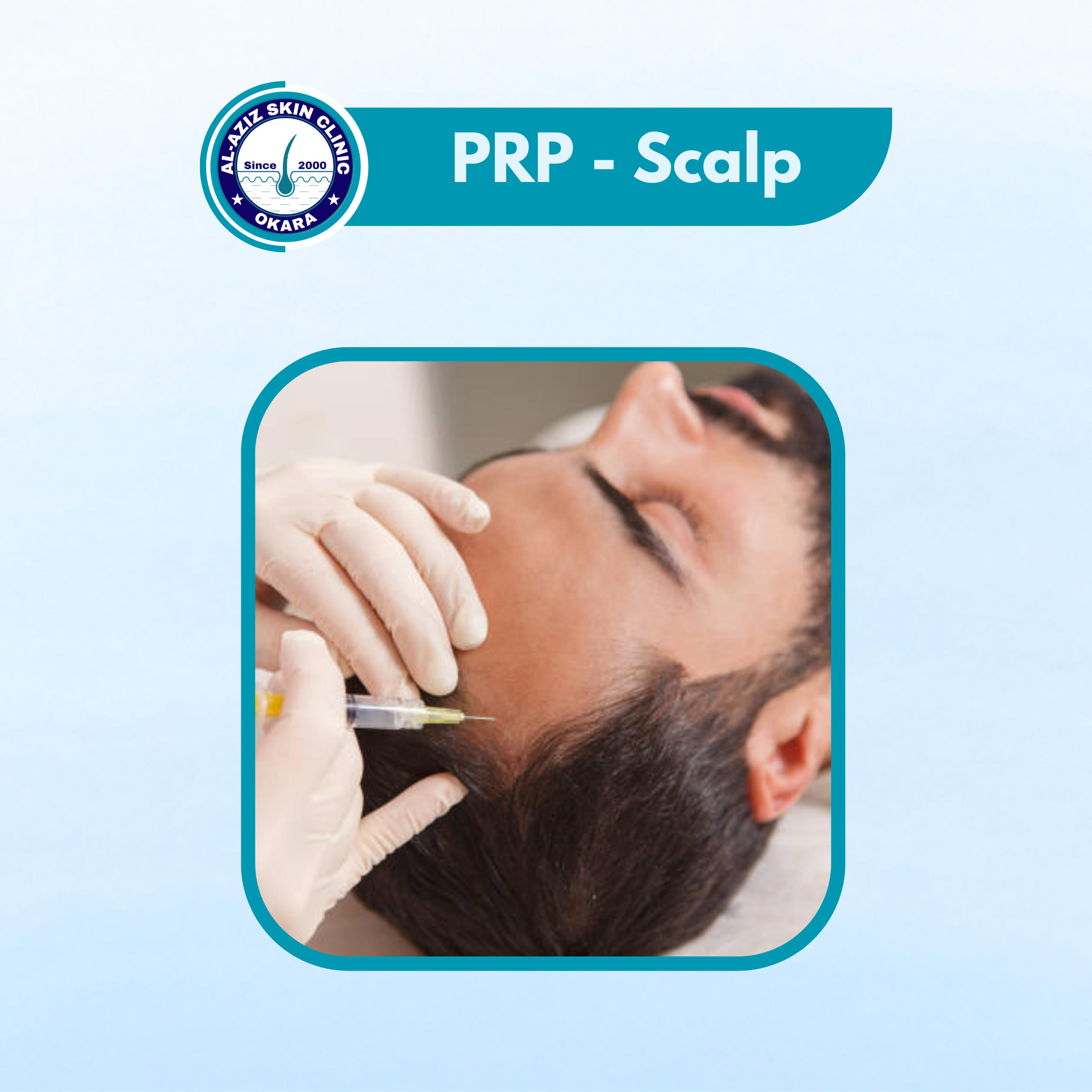 PRP Scalp